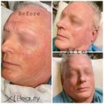 Xi Beauty | Skincare & Eyelash Extension