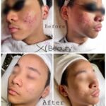 Xi Beauty | Skincare & Eyelash Extension