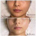 Xi Beauty | Skincare & Eyelash Extension