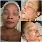 Xi Beauty | Skincare & Eyelash Extension