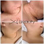Xi Beauty | Skincare & Eyelash Extension