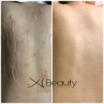 Xi Beauty | Skincare & Eyelash Extension