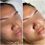 Xi Beauty | Skincare & Eyelash Extension