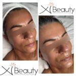 Xi Beauty | Skincare & Eyelash Extension