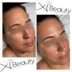 Xi Beauty | Skincare & Eyelash Extension