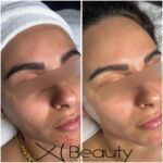 Xi Beauty | Skincare & Eyelash Extension