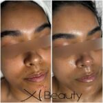 Xi Beauty | Skincare & Eyelash Extension