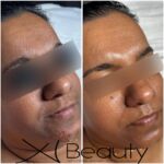 Xi Beauty | Skincare & Eyelash Extension