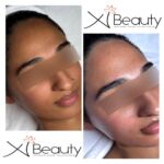 Xi Beauty | Skincare & Eyelash Extension