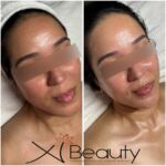 Xi Beauty | Skincare & Eyelash Extension