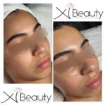Xi Beauty | Skincare & Eyelash Extension