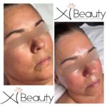 Xi Beauty | Skincare & Eyelash Extension