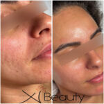 Xi Beauty | Skincare & Eyelash Extension