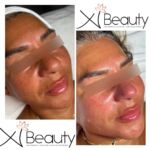 Xi Beauty Skincare and eyelash extensions